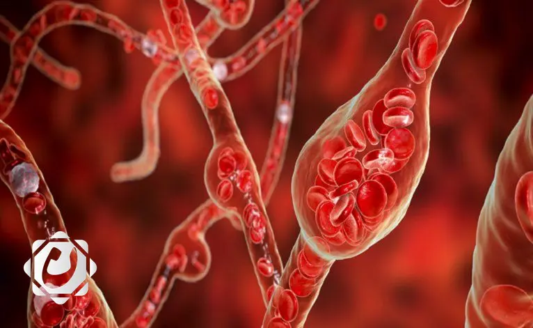 دراسة تكشف فعالية مكمل طبيعي في خفض ضغط الدم المرتفع