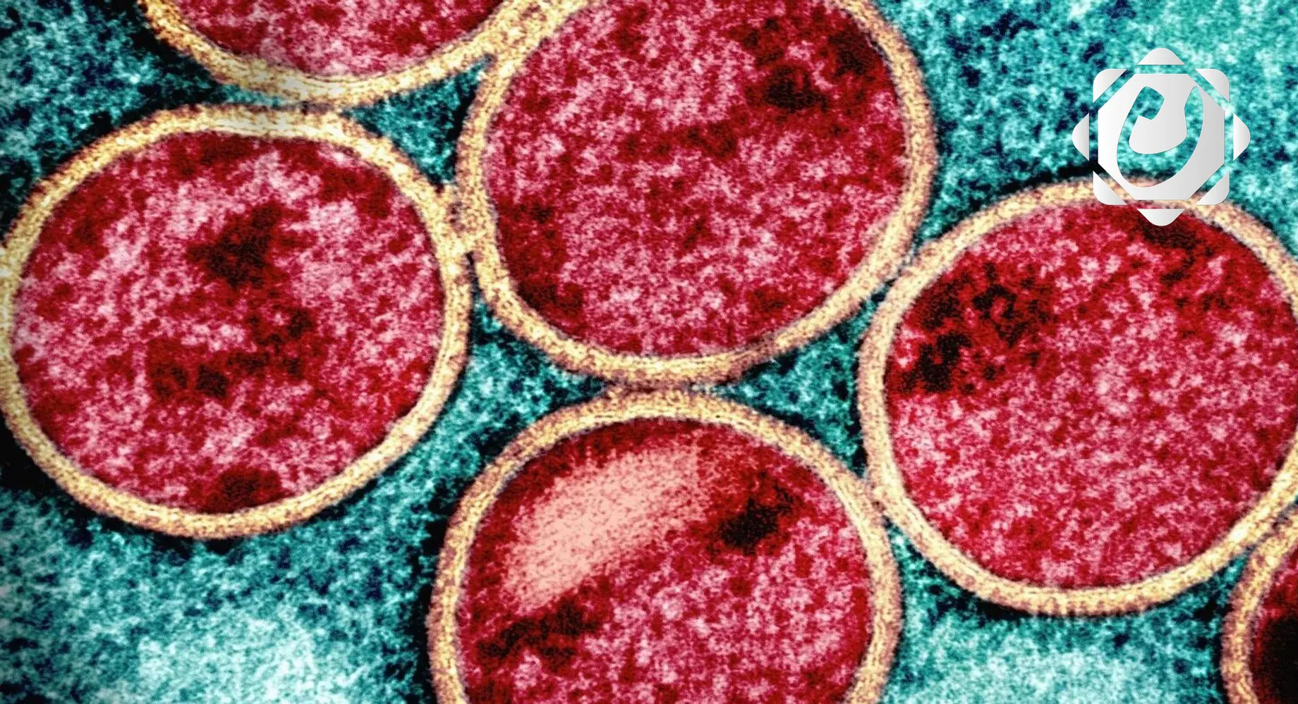 الصحة العالمية تعلن رفع حالة الطوارئ المتعلقة بجدري القرود