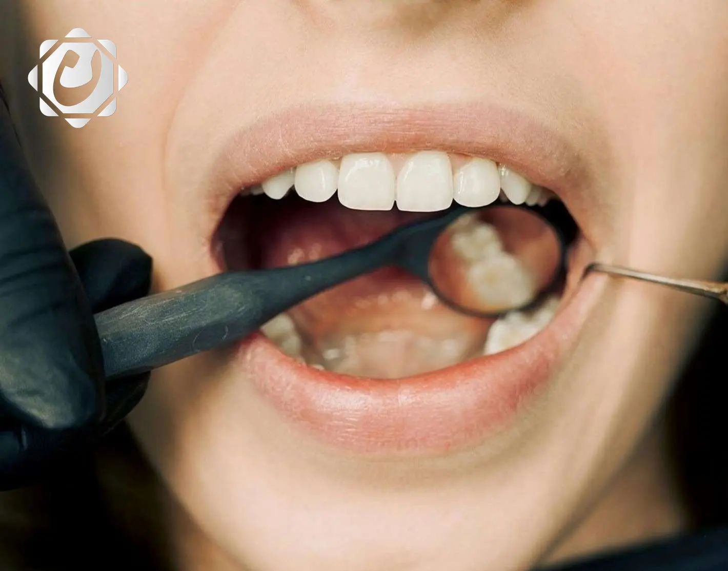 دراسة: العلاقة بين صحة الفم وأمراض القلب